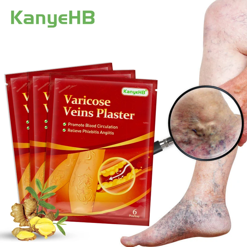 

18Pcs=3Bags Herbal Varicose Veins Relief Patch Vasculitis Phlebitis Spider Pain Relief Plaster Vein Swollen Treatment Patch A594