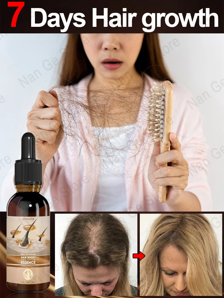 

Unisex Hair Growth Oil Hair Loss Treatment Rapid Hair Growth Effective Baldness Repair Hereditary Postpartum Hair Loss