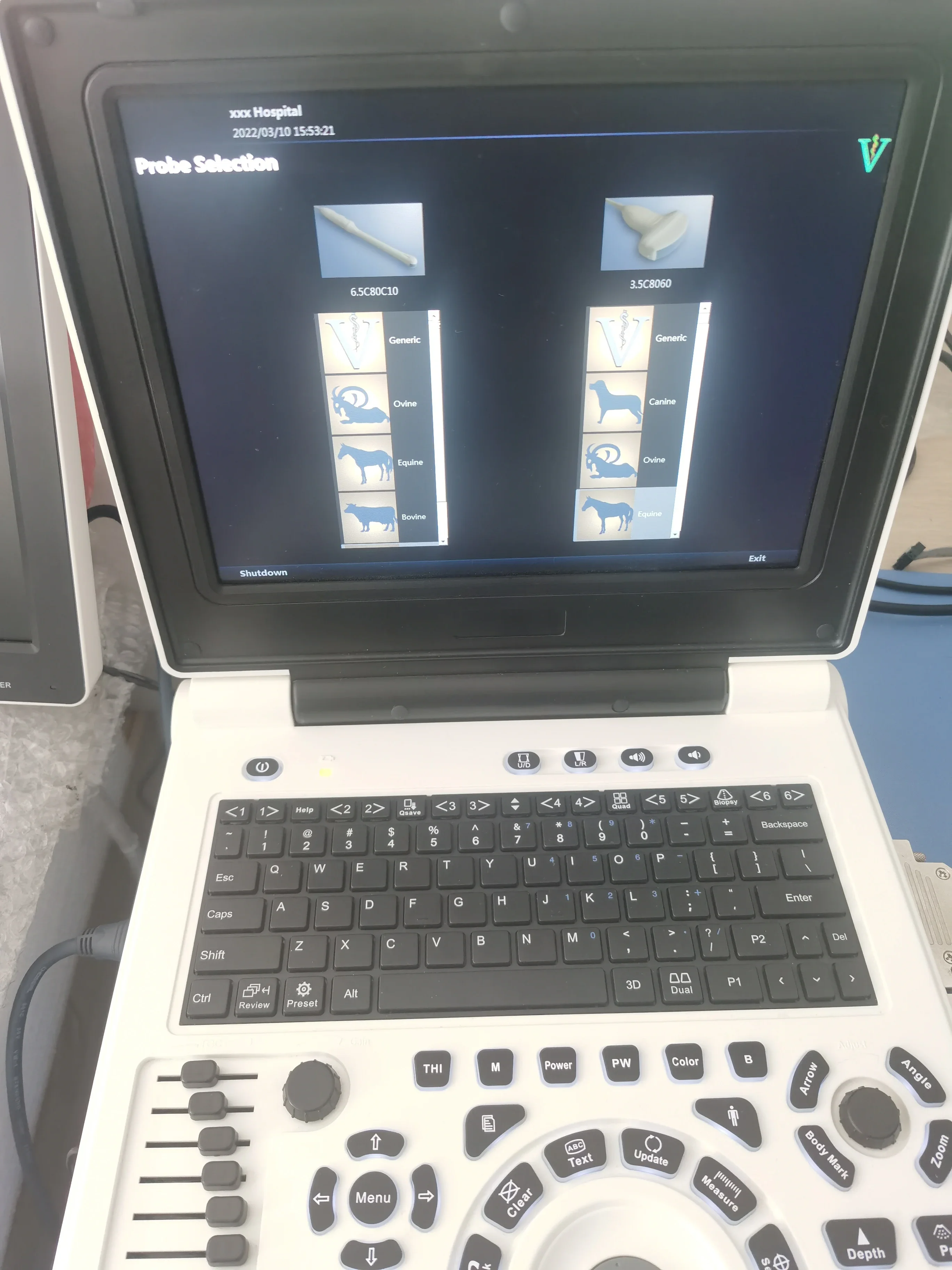 Медицинская кардиология портативный 12-дюймовый ультразвуковой аппарат цифровой