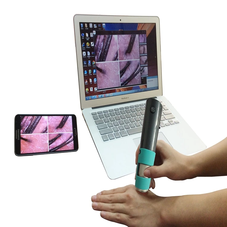 Беспроводная камера для кожи головы автоматически анализация HD обнаружение