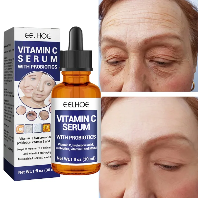 Vitamin C Face Serum Reduce Black Spots Wrinkle Remover Anti-Acne Marks Essence Whitening Brighten Moisturizing Facial Skin Care