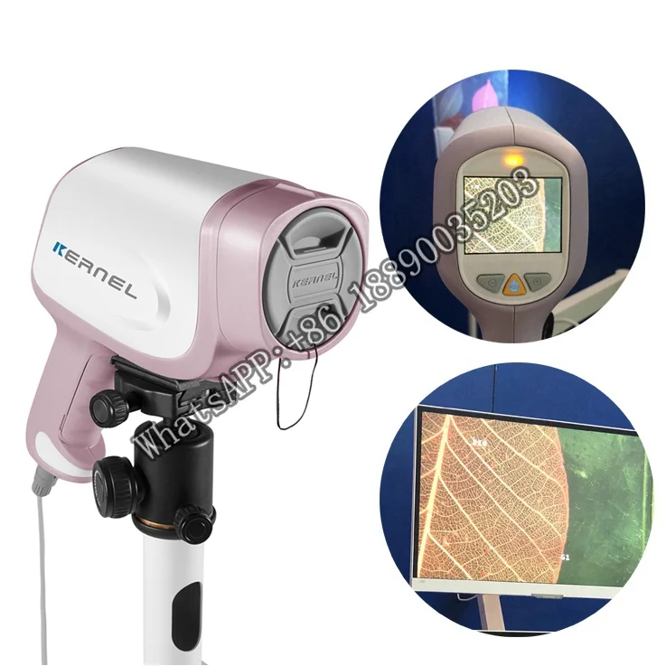 

Kernel colposcopy gynecology Electronic Cervical Video Colposcope Camera Machine Equipment For Gynecology kn-2200
