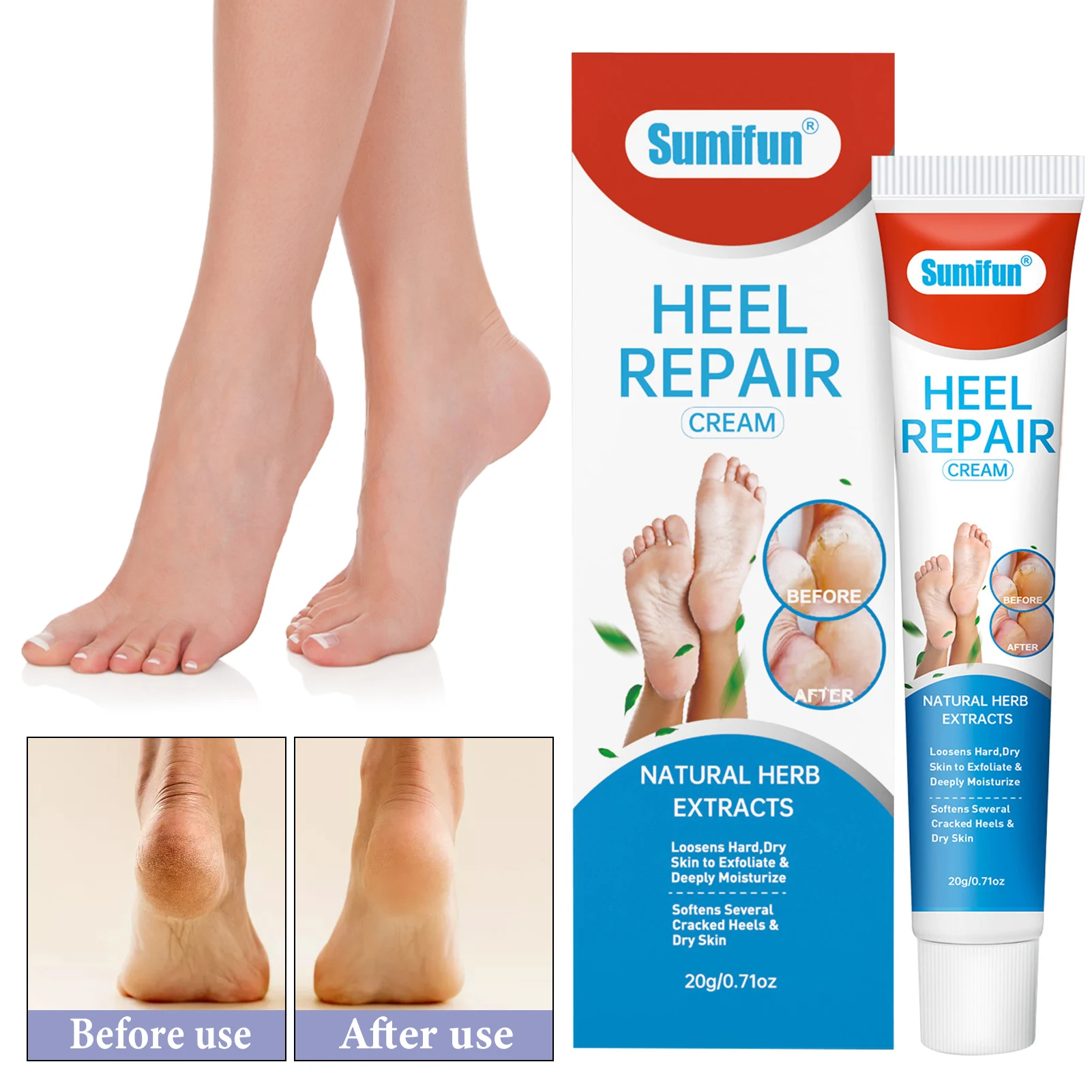 

Herbal Effective Foot Cream Treatments Paronychia Toe Funguses Gel Repair Dry Crack Feet Care Heel Repair Feet Care