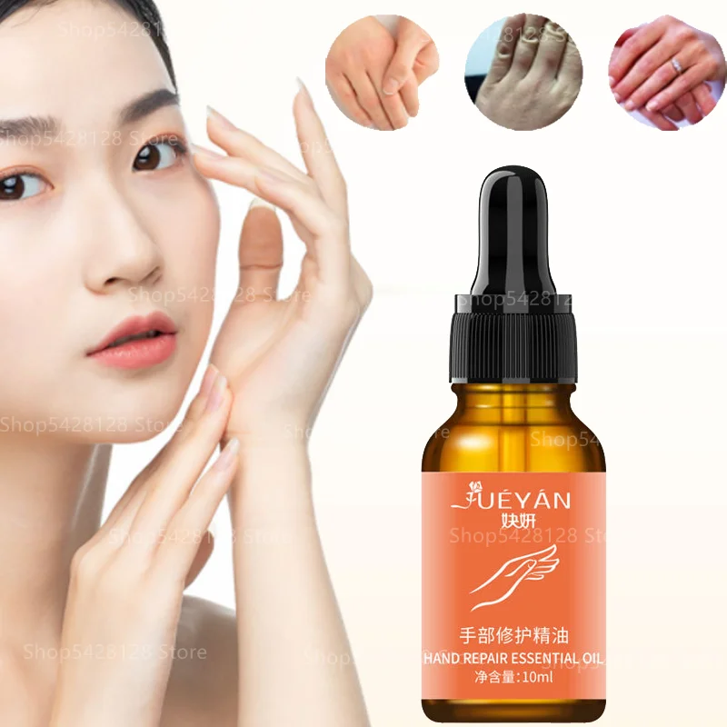 

10ml Hand Nourishing Essential Oil Firming Slender Fingers, Delicate White Joints, Tender Hands, Chapped Essential Oil