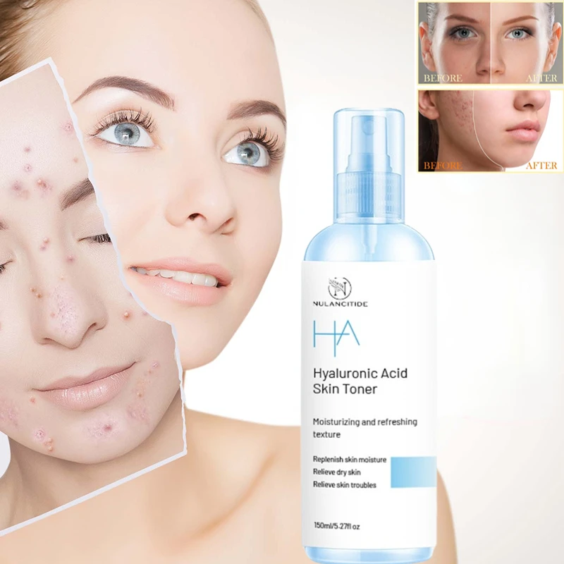 

Hyaluronic 150ml Acid Facial Moisturizer Anti-Aging Skin Brightening Spray Facial Toner Hydrating Facial Korean Skincare General
