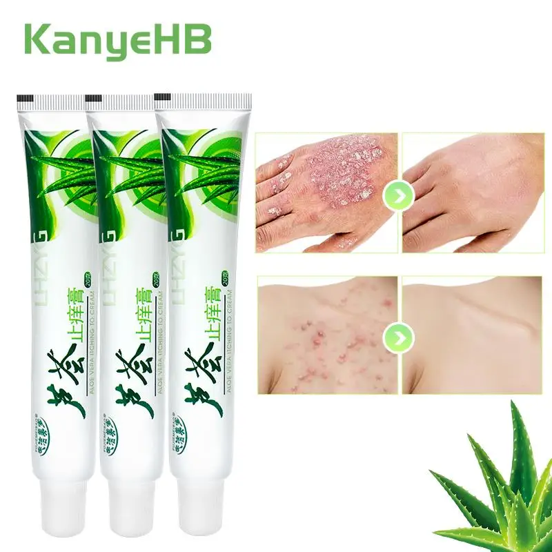 

3Pcs Psoriasis Cream Repair Tinea Of Hands And Feet Eczema Skin Rash Urticaria Desquamation Antibacterial Herbal Ointment A1311