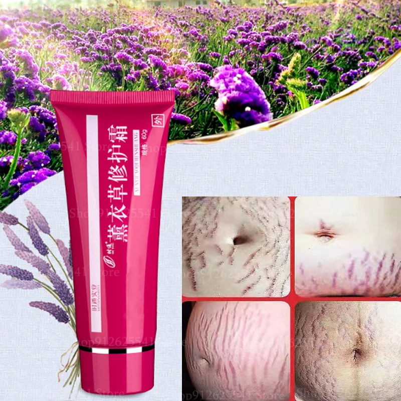 

Натуральный Крем для удаления шрамов от акне, лаванды