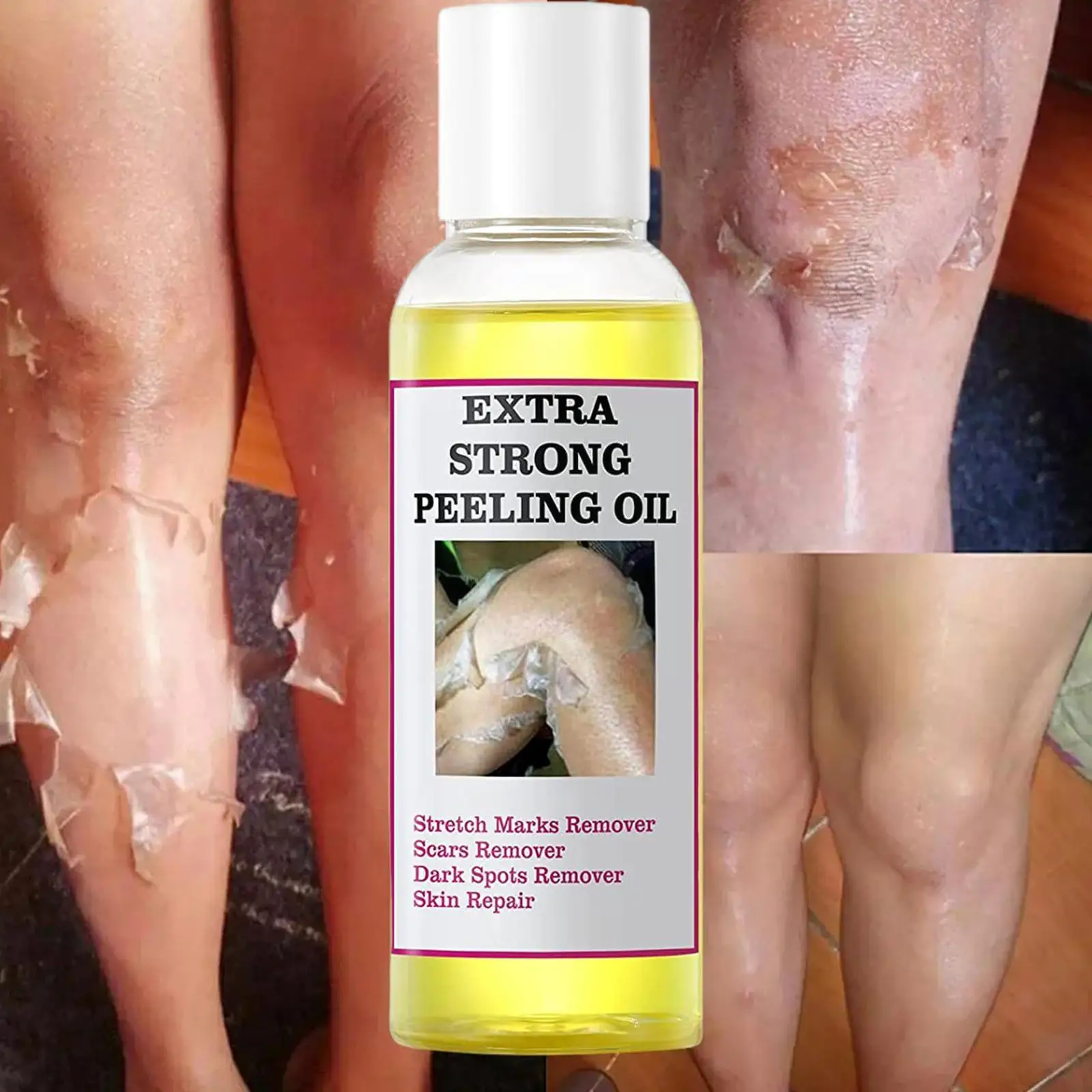 Рисунок 2 - Желтый пилинг, масло