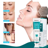 whitening freckles cream brighten skin remove melasma dark spots melanin anti aging moisturizing brightening face skin care 20ml