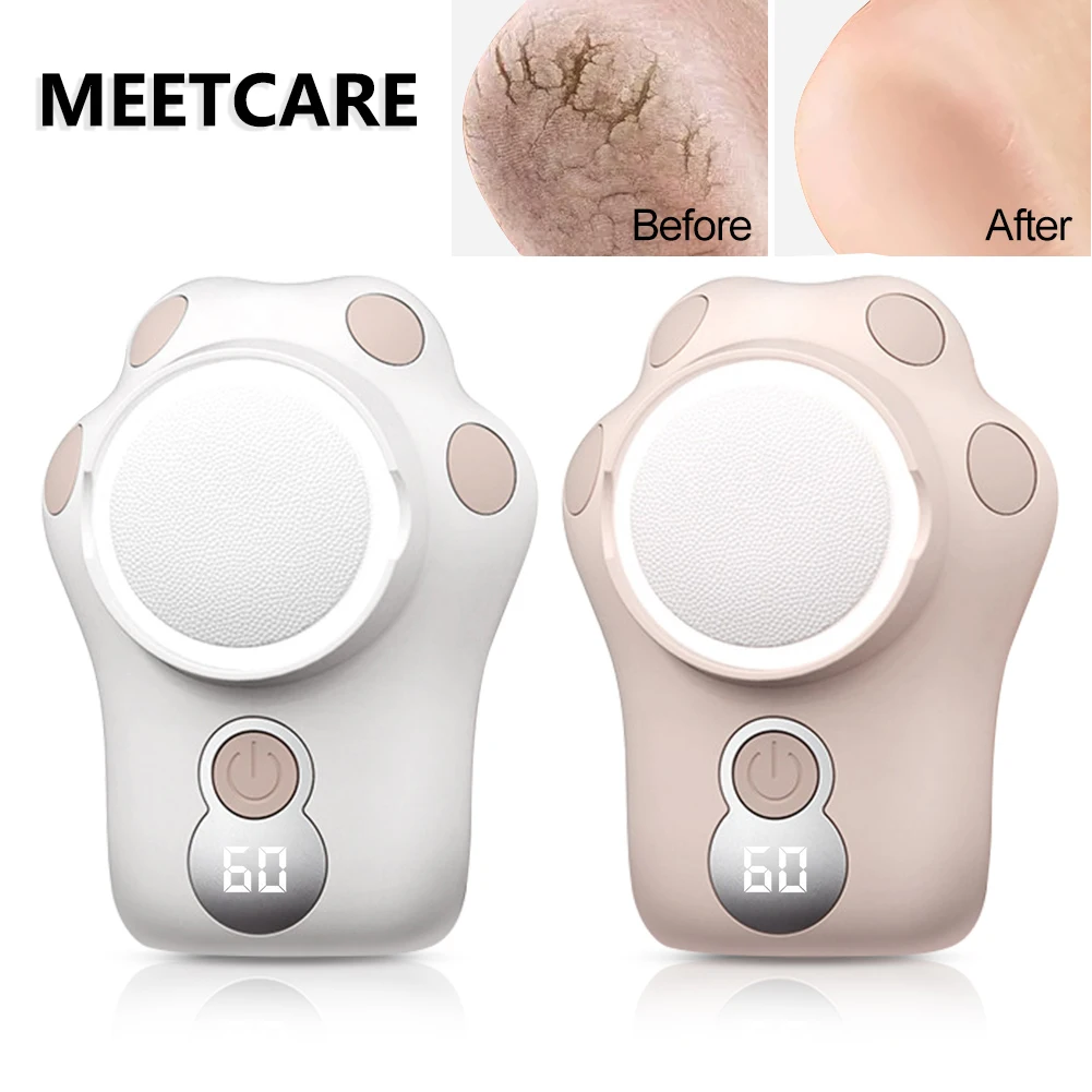 Устройство для удаления огрубевшей кожи с 3 насадками