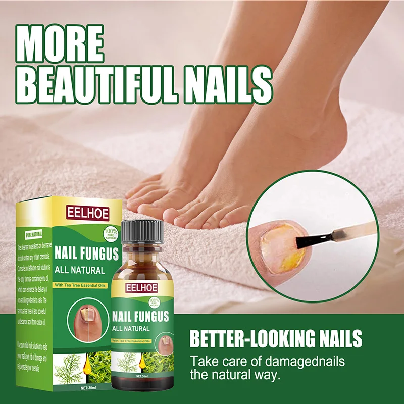 

Nails Repair Fluid Fungal Nail Serum Care Onychomycosis Paronychia Anti-Fungal Nail Toe Fungus Foot Repair Serum Crack Care 30ml