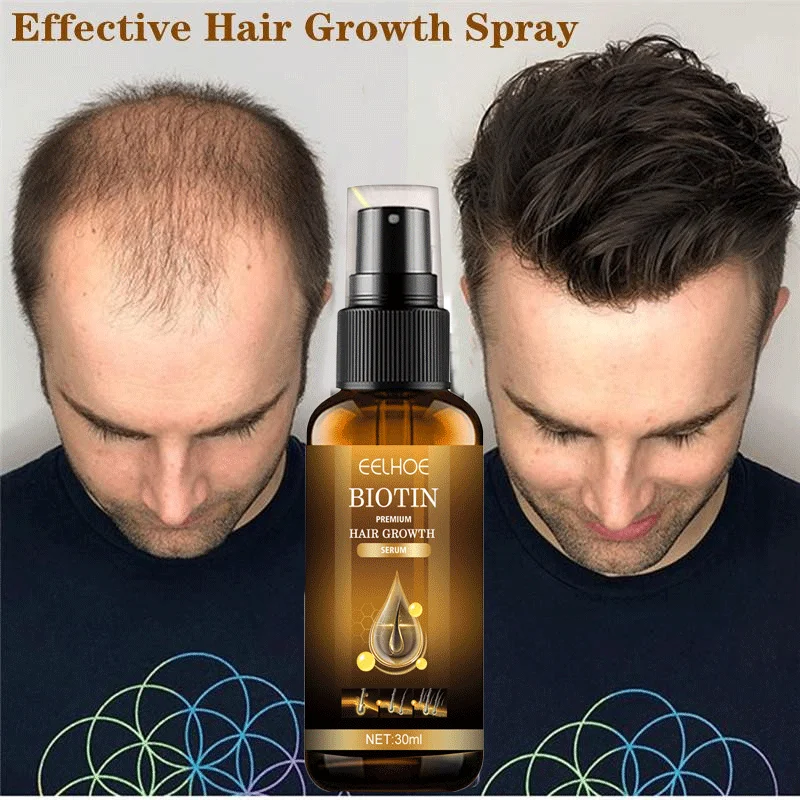 Anti Alopecia Oil Hair Growth Essential Prevent Edges Bald Thin Hair Promote Hair Grow Thicker Nourish Hair Roots Men Women