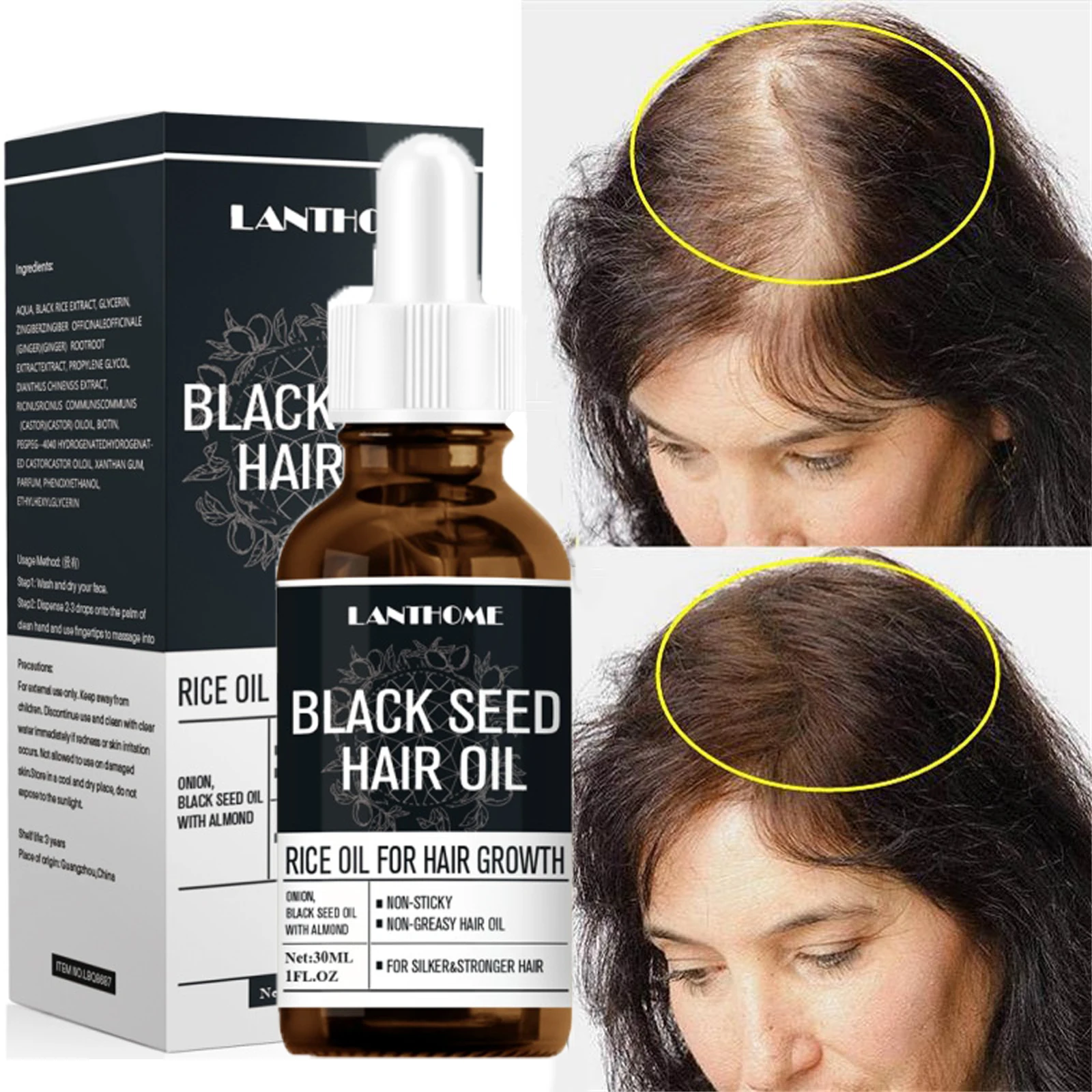 

Fast Hair Growth Essence Oil Natural Anti Hair Loss Prevent Baldness Treatment Nourishing Dry Damaged Hair Care For Men Women