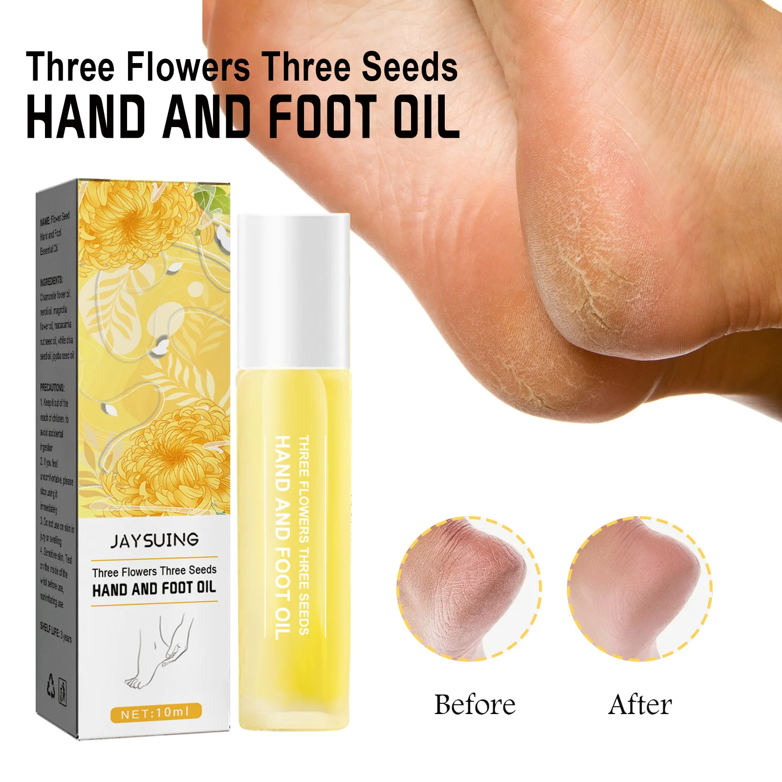 

Anti Crack Foot Oil Remove Callus Dead Skin Prevent Heel Cracked Repair Cream Anti-Drying Moisturizing Softing Hand Feet Care