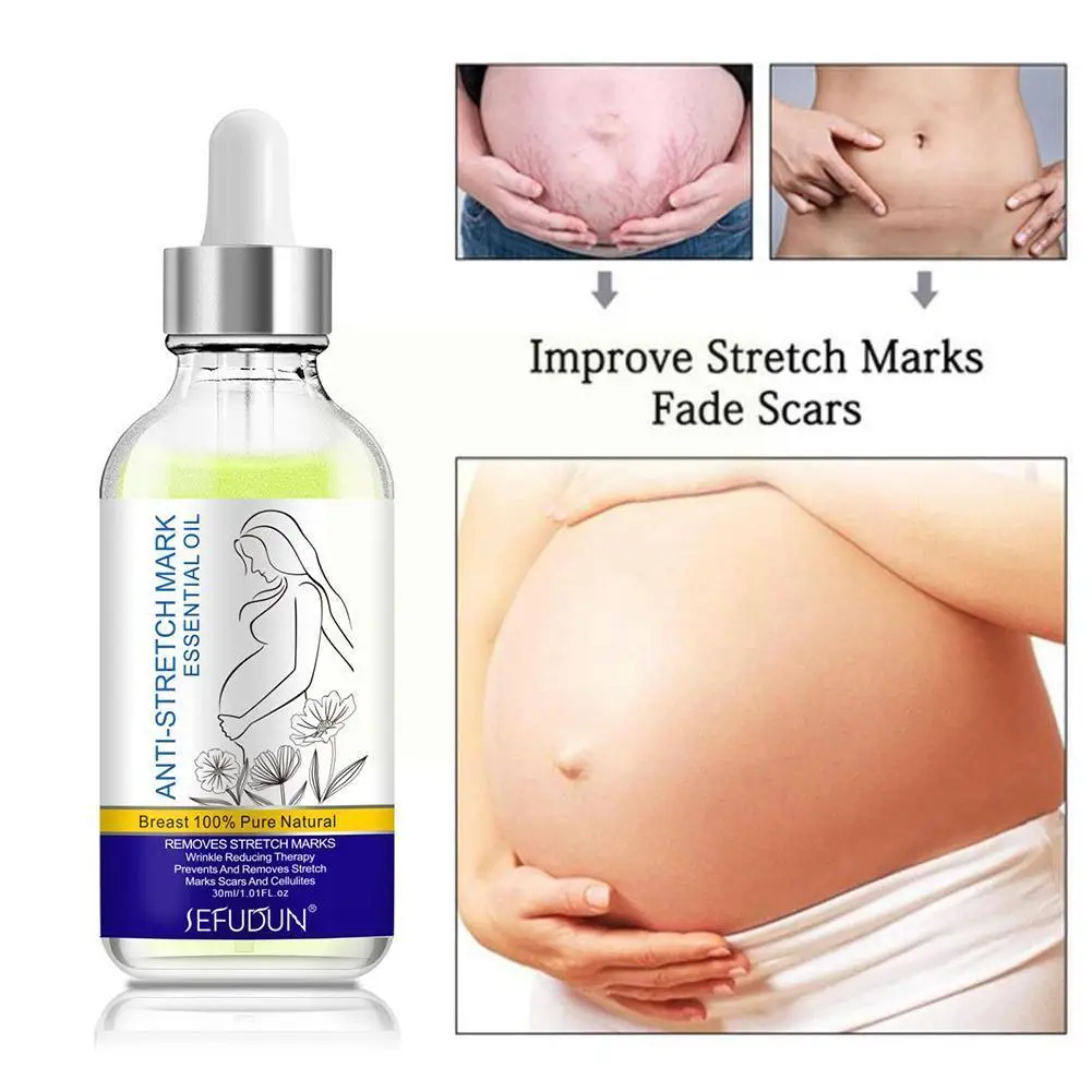30ml Stretch Mark Essential Oil Natural Herbal Skin Improve Stretch Skin Care Remove Marks Body Dryness M3u7