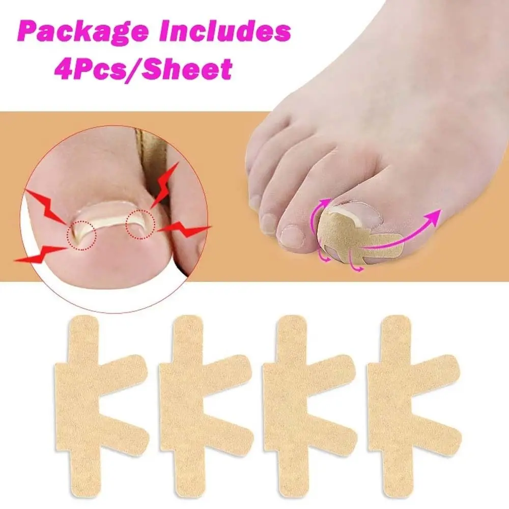 

4Pcs/Set Ingrown Toenail Correction Sticker Foot Care Paronychia Treatment Patch Nail Corrector Patch Correction Sticker