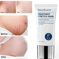 repair cream scar fade repair scar cream acne spots burn gel surgical scars treatment gentle whitening facial body skin care 30g