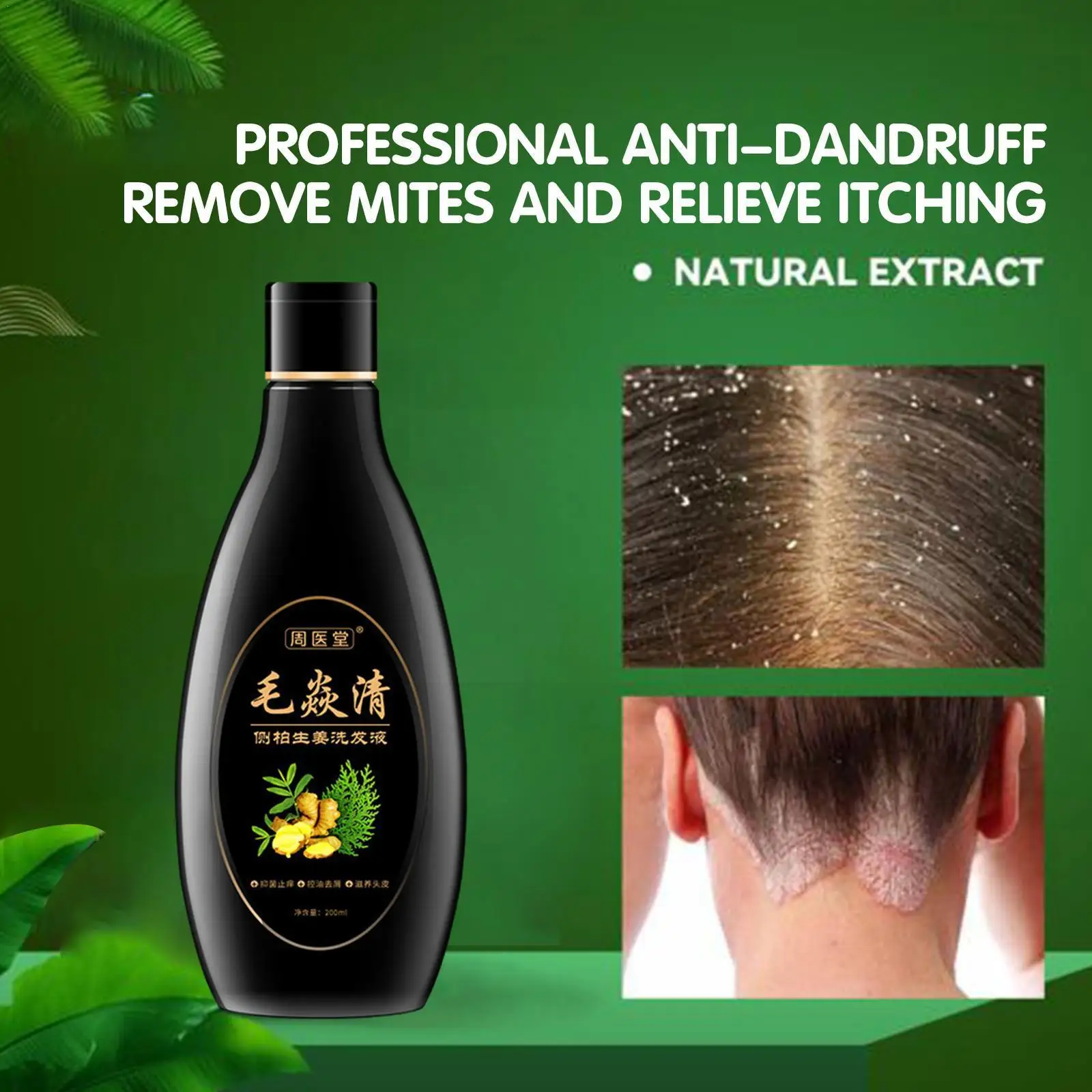 

Sdotter Scalp Cleansing Shampoo Skincare Product Scalp Hair Control Antibacterial Anti-itching Psoriasis Hair Mites Oil Shampoo