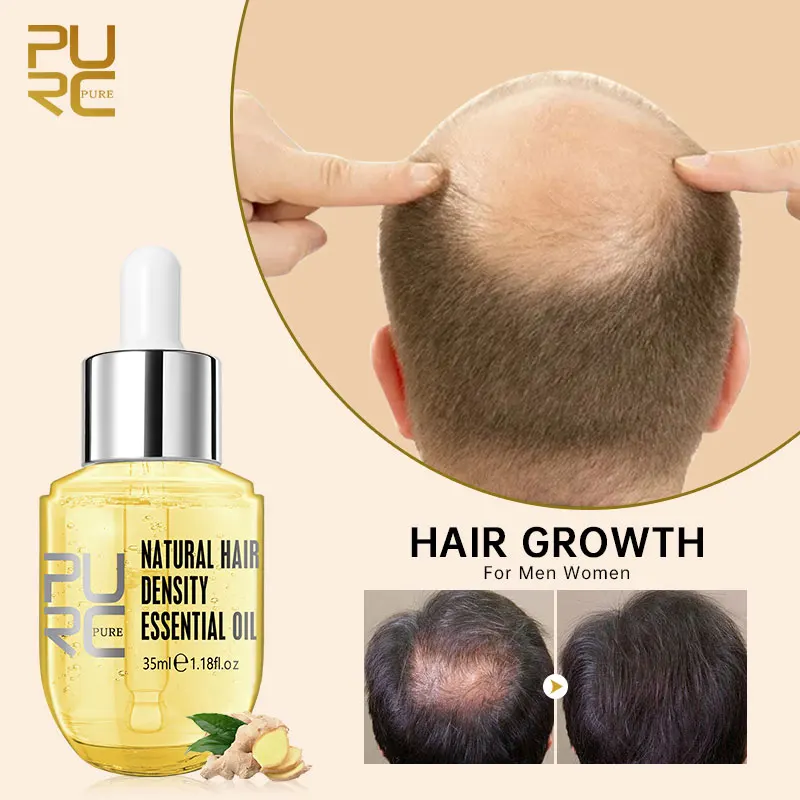 

Имбирь первой необходимости для роста волос спрей продукты для Jaysuing Корейская продукция для ухода за кожей волоконный гель для волос