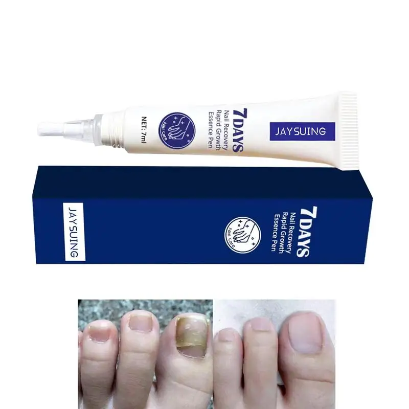 

Эссенция для восстановления ногтей, 7 мл