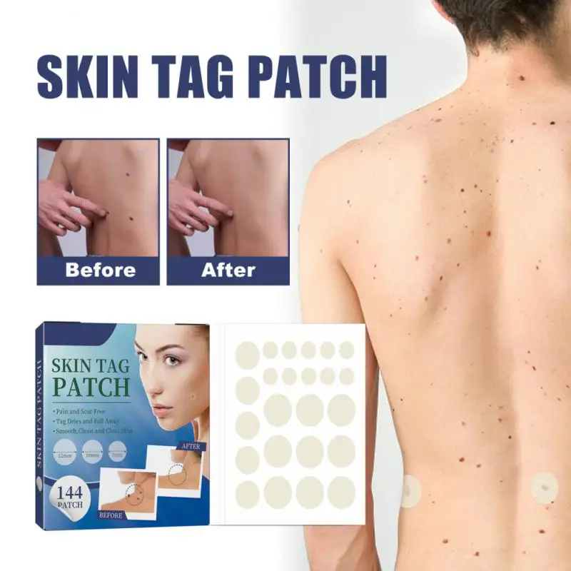 

144 Patches Skin Tag Remover Patch Wart Treatment Stickers Treatments Hydrocolloid Gel Acne Warts Invisible Skin Care Tool