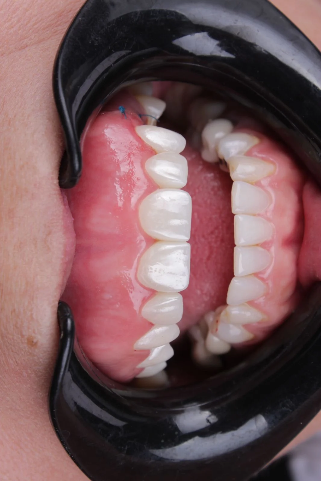 Фото Скидка 50%! Стоматологический 3D-блок из циркония Master для зуботехнических лабораторий, CAD/CAM, 16 цветов Vita, профессиональный диск из циркония для фрезерования зубных коронок №5