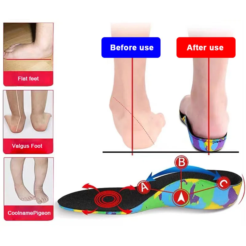 Flat Feet Template Arch Support Orthopedic Insoles,Kids Adults Plantar Fasciitis Heel Pain Orthotics Insole Sneakers Shoe Insert