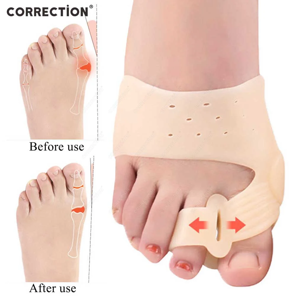 

CORRECTION Big Toe Straightener Thumb Valgus Protector Silicone Gel Foot Toe Separator Bunion Adjuster Feet Pad Relief Foot Pain