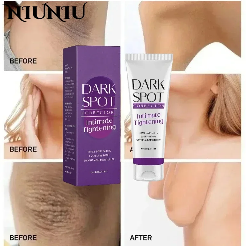 Осветляющий крем отбеливающие подмышки локти колени для кожи увлажняющий лосьон