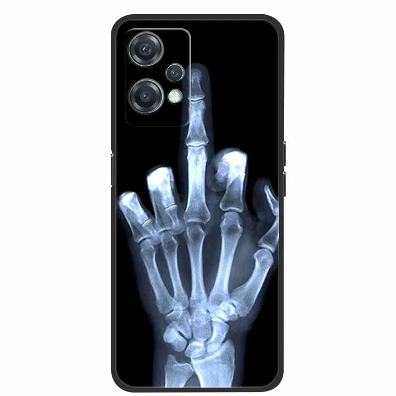 Для OnePlus Nord CE 2 Lite 5G Чехол Животные Силиконовый ТПУ Мягкий чехол для телефона CE2 Wolf