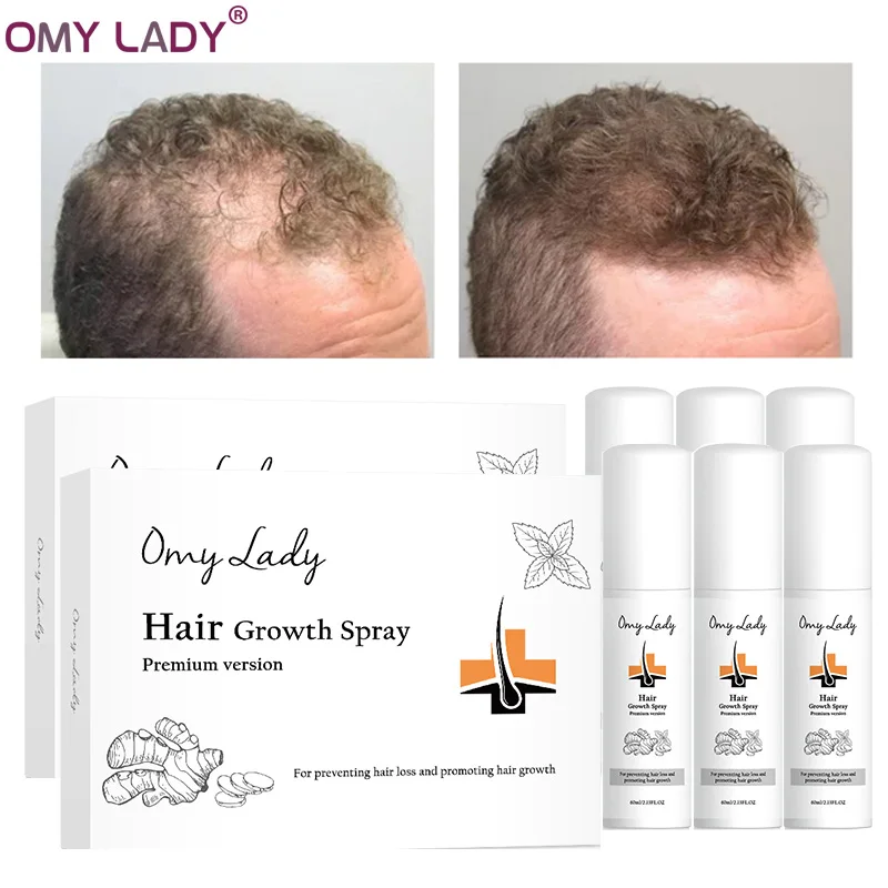 6 шт. OMY LADY спрей для роста волос против выпадения эфирное масло жидкость мужчин и