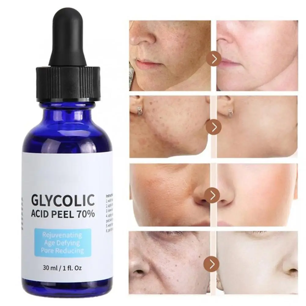 

Glycolic Acid Peel Purity 70% Concentration 5% Skin Repair Invisible Pores Brighten Skin Tone Treat Acne Mild Non-Irritating