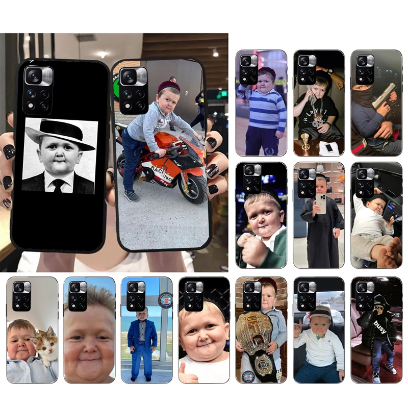 

Phone Case For Xiaomi Redmi Note 12Pro 11 11S 11T Pro 10 9Pro Note10S Redmi 10 9 10C 9C Hasbulla Magomedov Case