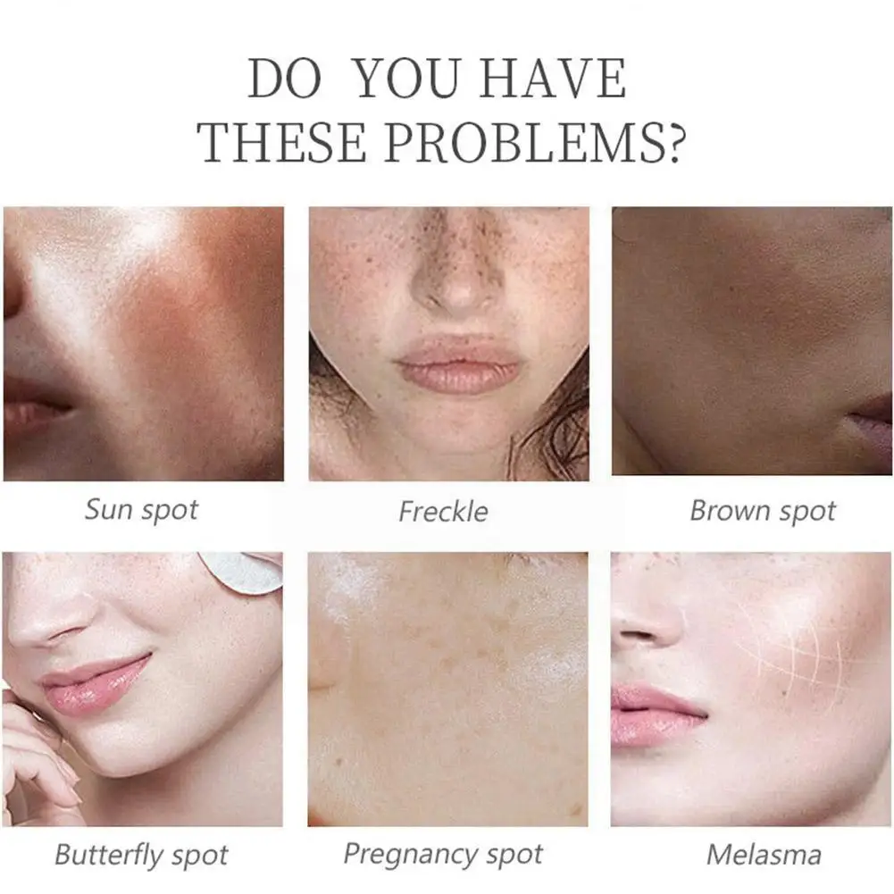 

Отбеливание Коллагена 30 мл Сыворотка для лица антиокислительная осветляющая сыворотка для веснушек Осветление кожи лица увлажняющий уход ...