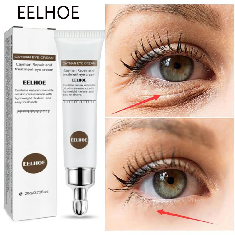 

Hyaluronic Acid Moisturizing Eye Cream Fade Fine Lines Anti-Puffiness Remove Eye Bags Dark Circles Nourish Brightening Eye Care