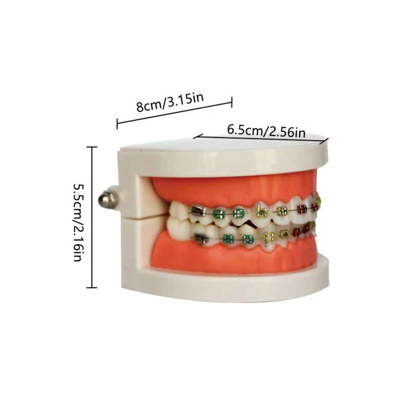Стоматологическая Ортодонтическая модель полуметаллические керамические скобы