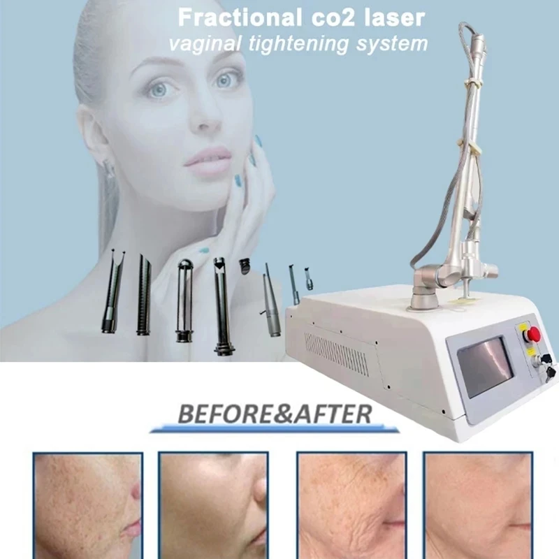 

Новейший CE Co2 Фракционный лазер/для шрамов фракционный лазер Co2/удаление пигмента для укрепления влагалища, лифтинг лица/поверхность кожи