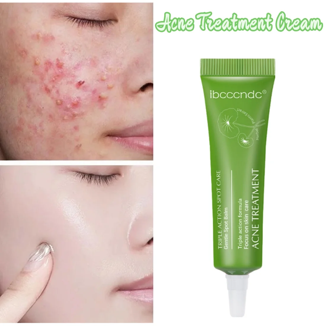 Эффективное средство для лечения акне