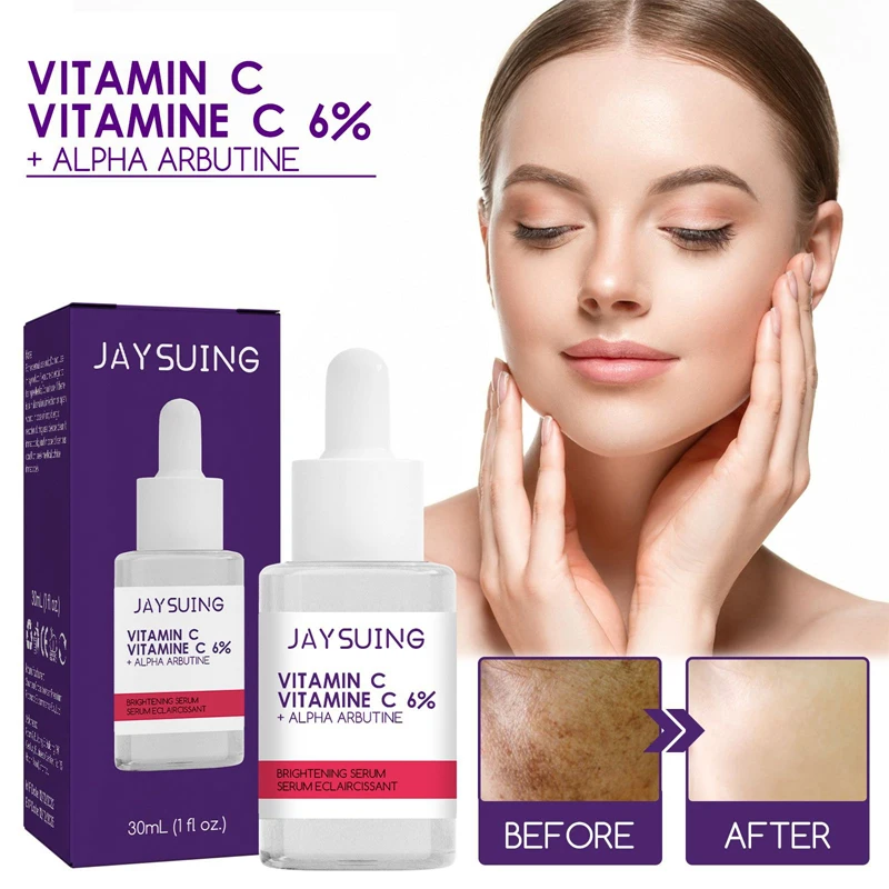 

Vitamin C Whitening Freckle Face Serum Remove Melasma Acne Dark Spots Pigmentation Brighten Moisturizing Nourish Skin Care 30ml