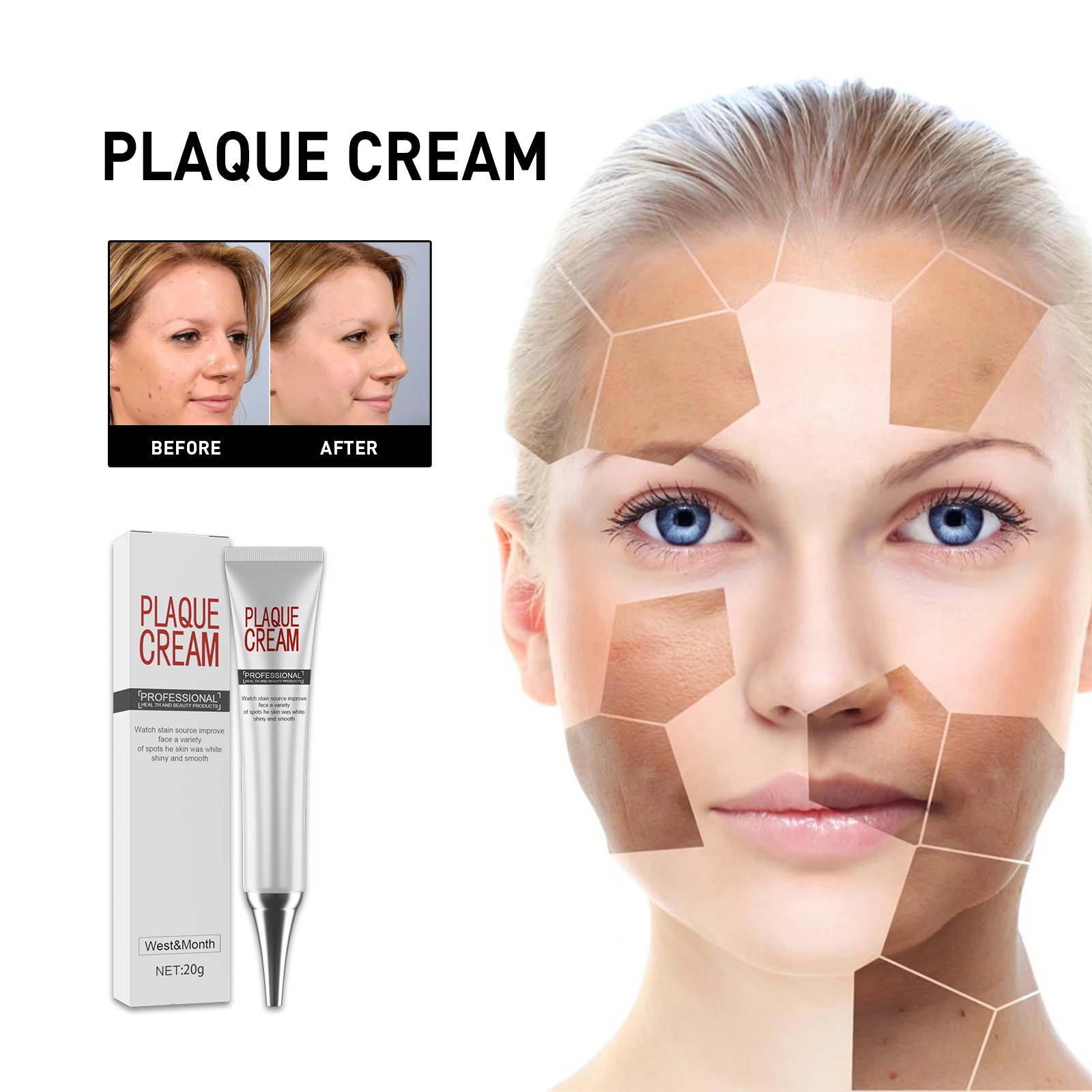 

Крем для отбеливания пятен, для удаления темных пятен chlo, хлоазма, осветляет меланин, улучшает долговечность, антивозрастной уход за кожей лица 20 г