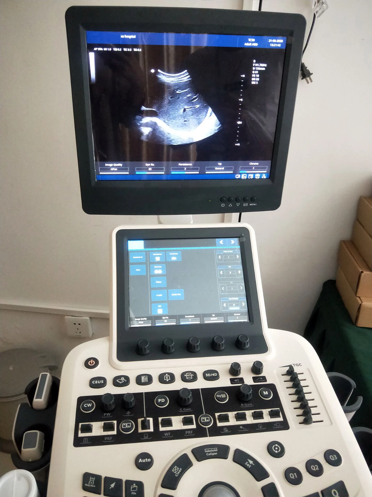 Рисунок 6 - Ультразвуковое оборудование для