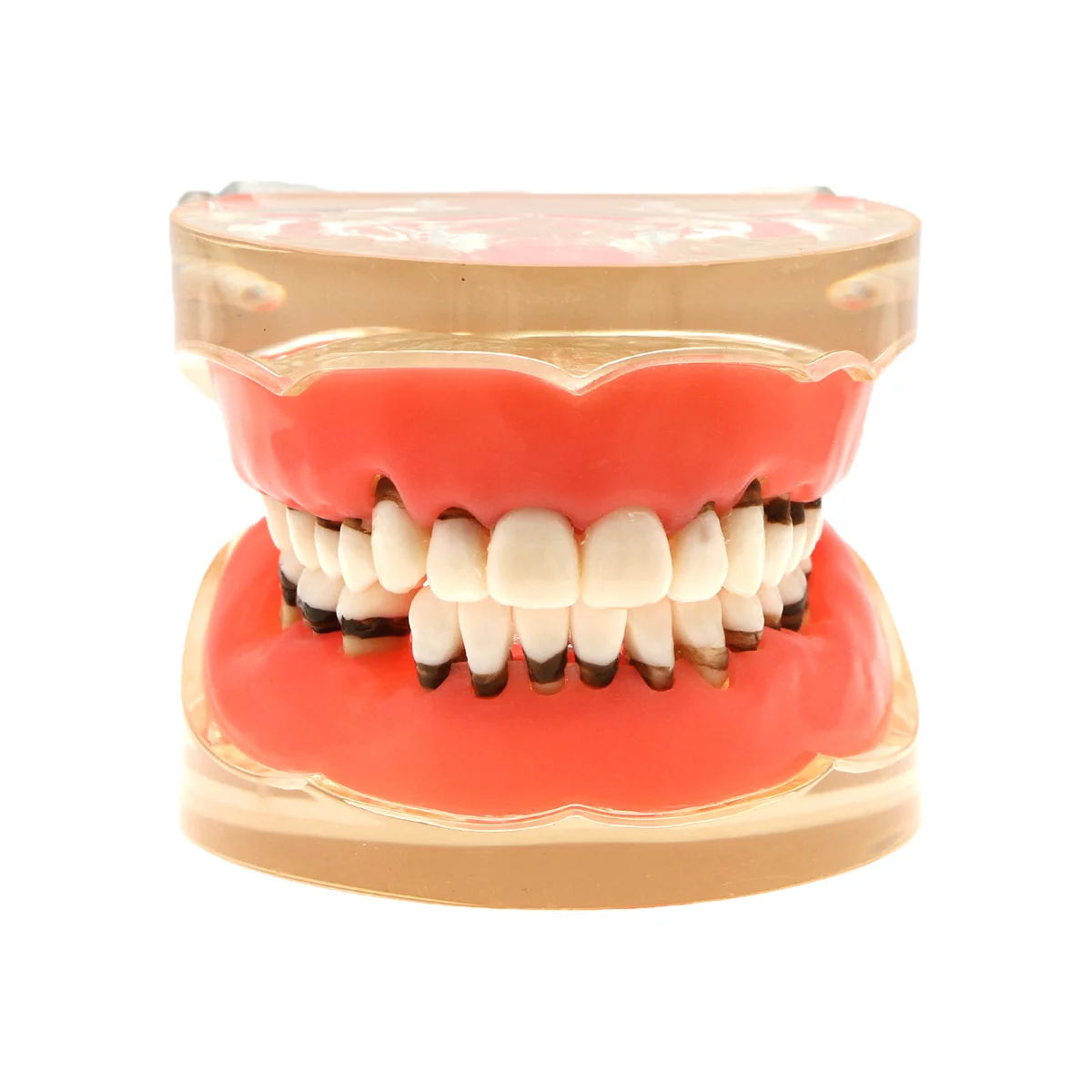 

Dental Model Adult Pathological Periodontal Disease Study Teach Teeth M4017