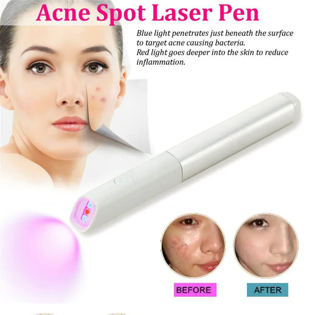 Portable Red Blue Light Therapy Face Acne Spot Treatment Laser Acne Pen Acne Scar Pimple Wrinkle Removal Pen Beauty Instrument