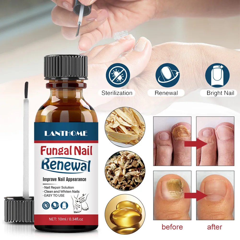 

10ML Nail Repair Essence Fungus Treatment for Fingernails Toenails Improves the Appearance Toenail Fungus Treatment on Nails