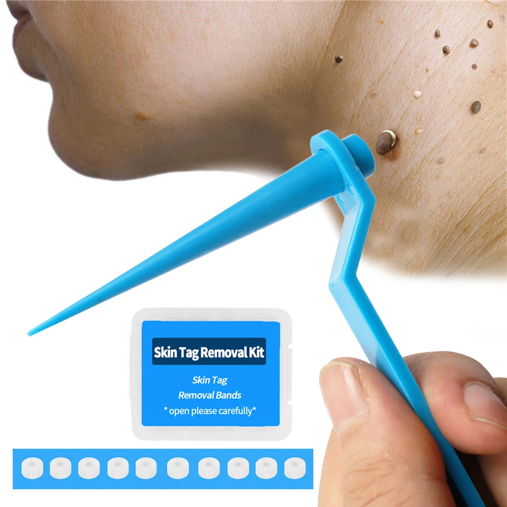 

Skin Tag Remover Device for Large Mole Wart Removal with Removal Bands Cleansing Wipes for Face Neck Body Facial Skin Care