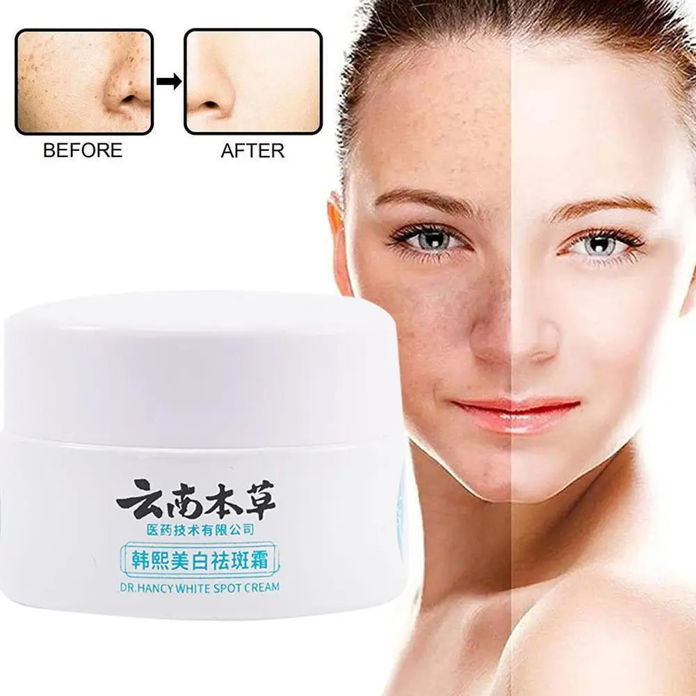 

20g Herb Powerful Whitening Freckle Cream Remove Acne Spots Dark Spots Face Moisturizing Face Skin Care Beauty Yun Nan