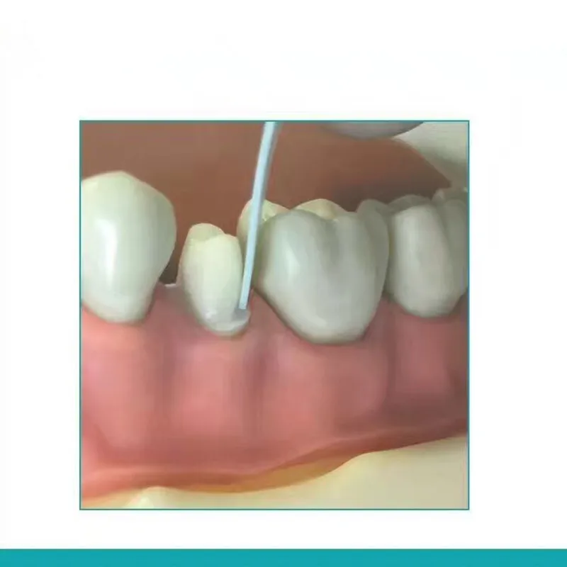 "4Pcs/set Dental Interproximal Reduction Gauge Reciprocating IPR System Orthodontic Treatment