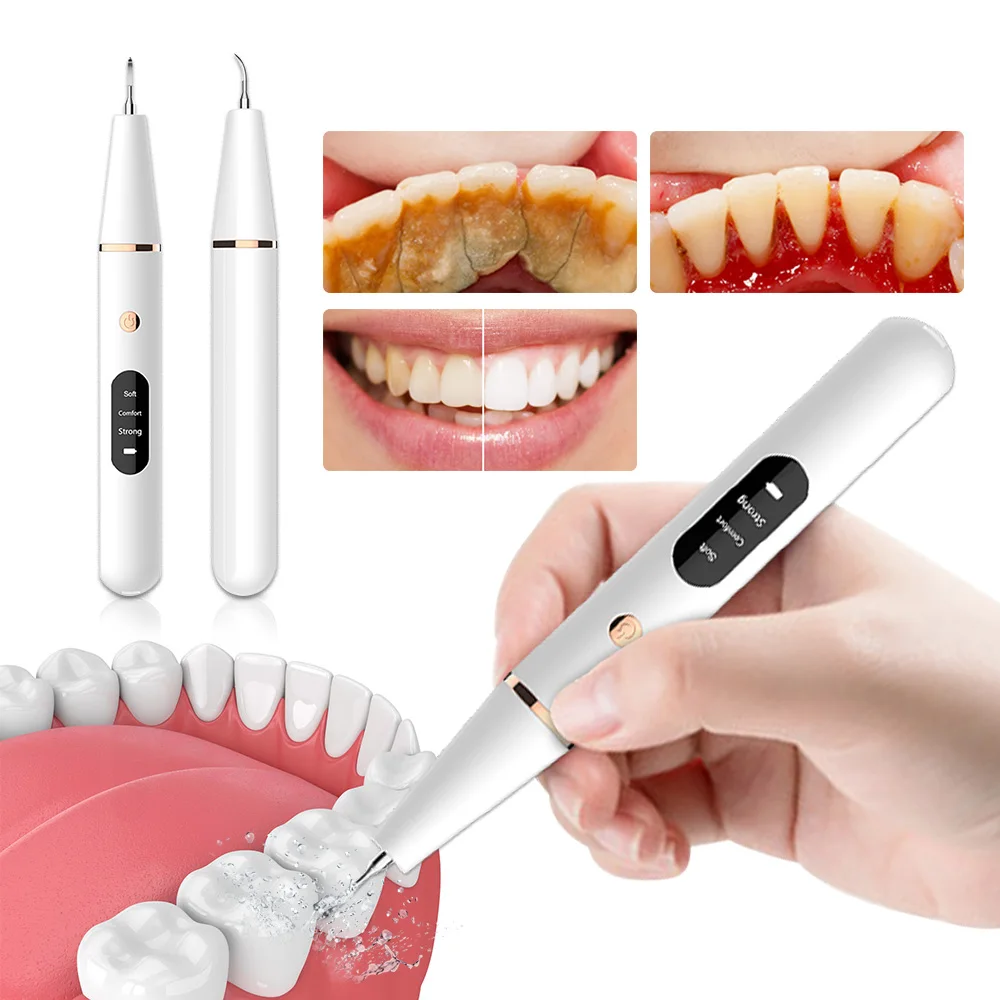 

Ultrasonic Electric Sonic Dental Calculus Scaler Oral Teeth Tartar Remover Plaque Stains Cleaner Removal Teeth Whitening Portabl