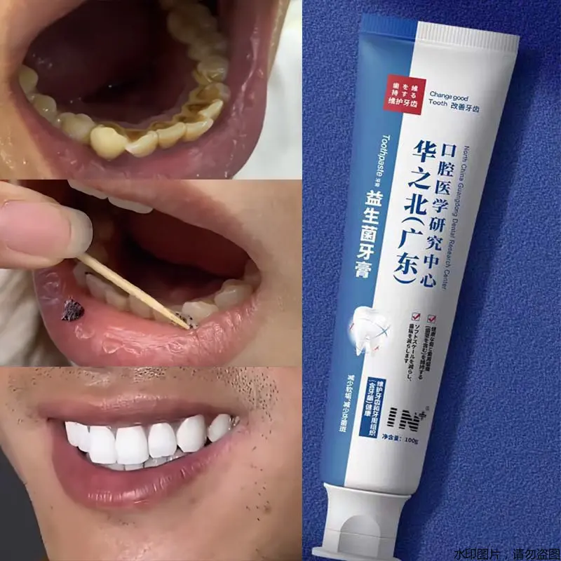 

Quick Repair of Cavities Caries Filling Removal of Plaque Stains Decay Whitening Yellowing Repair Teeth Teeth Whitening 100g