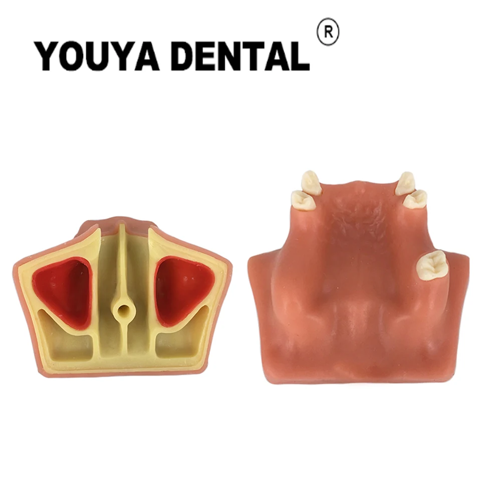 

Maxillary Sinus Tooth Implant Practice Model Dental Model For Dentist Student Training Teaching Modeling Demonstration Tool